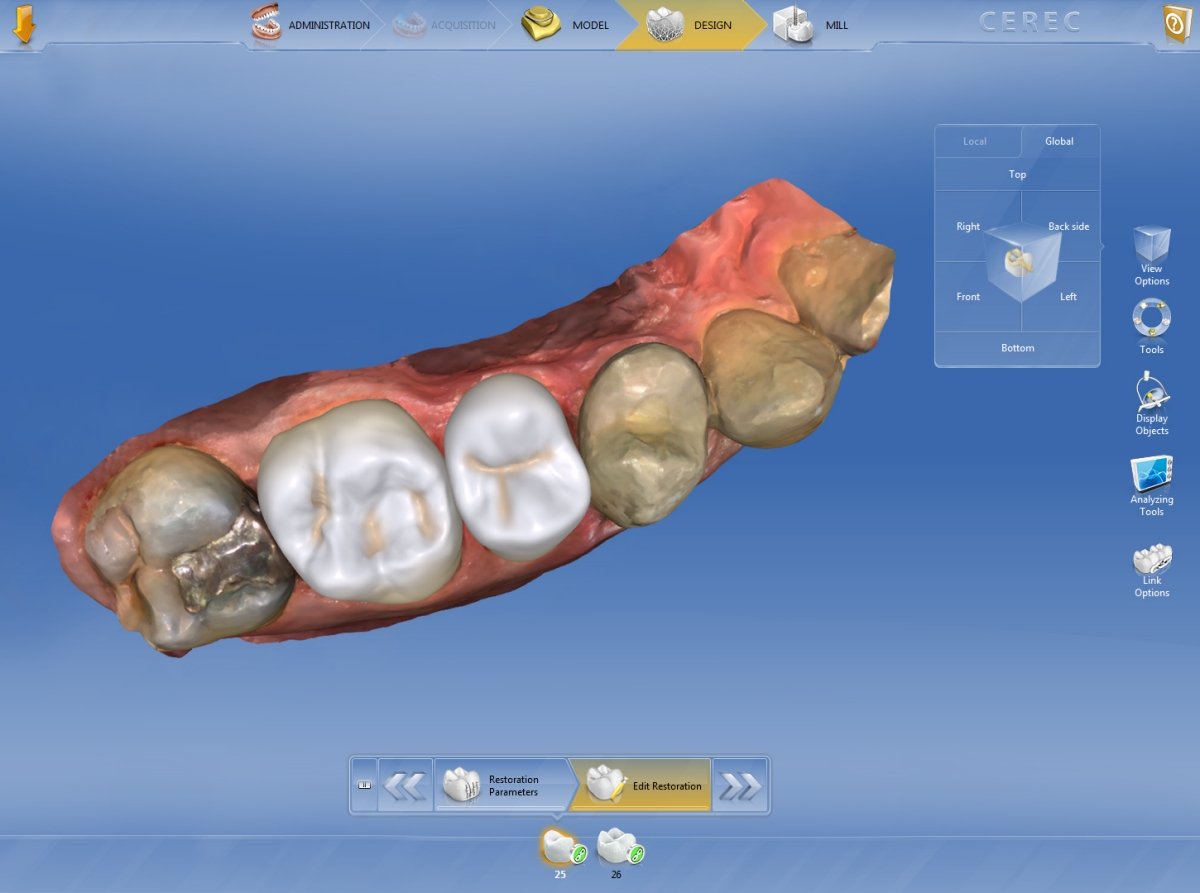 30 anni di CEREC: più flessibile e più efficiente