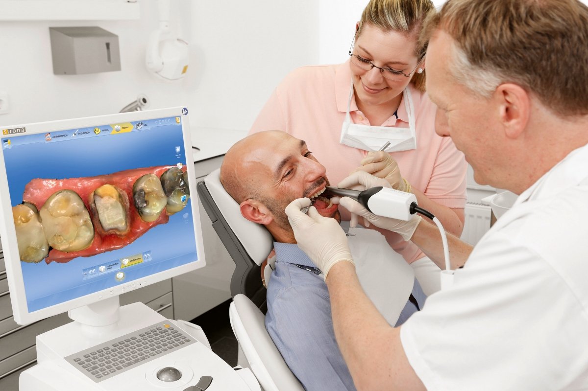 CEREC Omnicam: impronte 3D senza polvere opacizzante e a colori