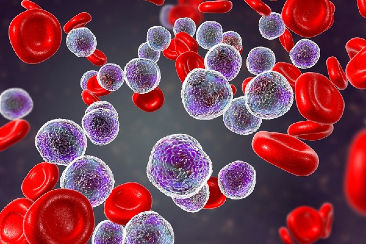 ERYTECH estende il suo studio di Fase IIb nella Leucemia Mieloide Acuta