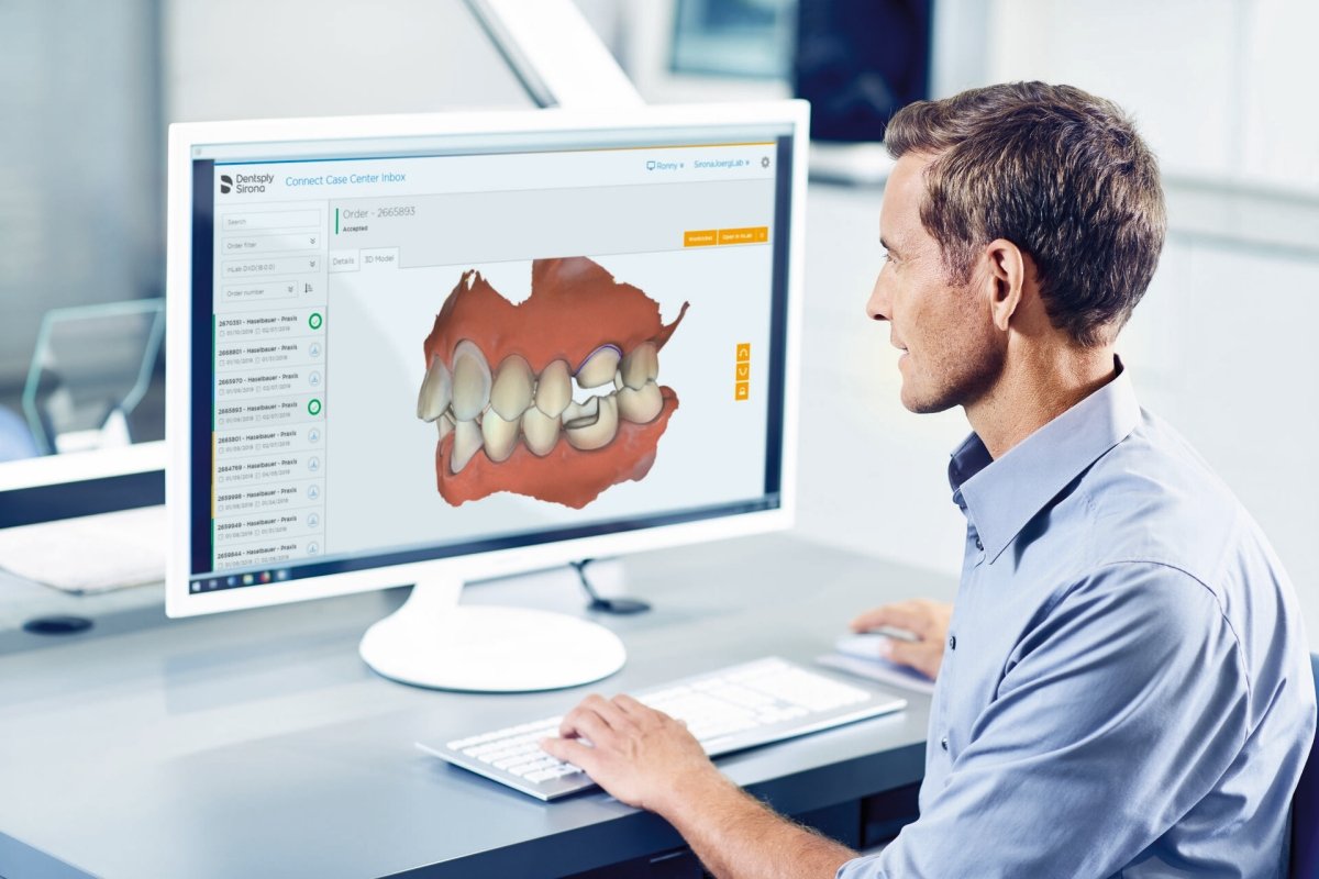 Gestione dei dati delle impronte semplificata grazie alle soluzioni Dentsply Sirona