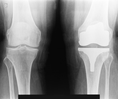 I produttori di impianti medicali puntano sulla ceramica