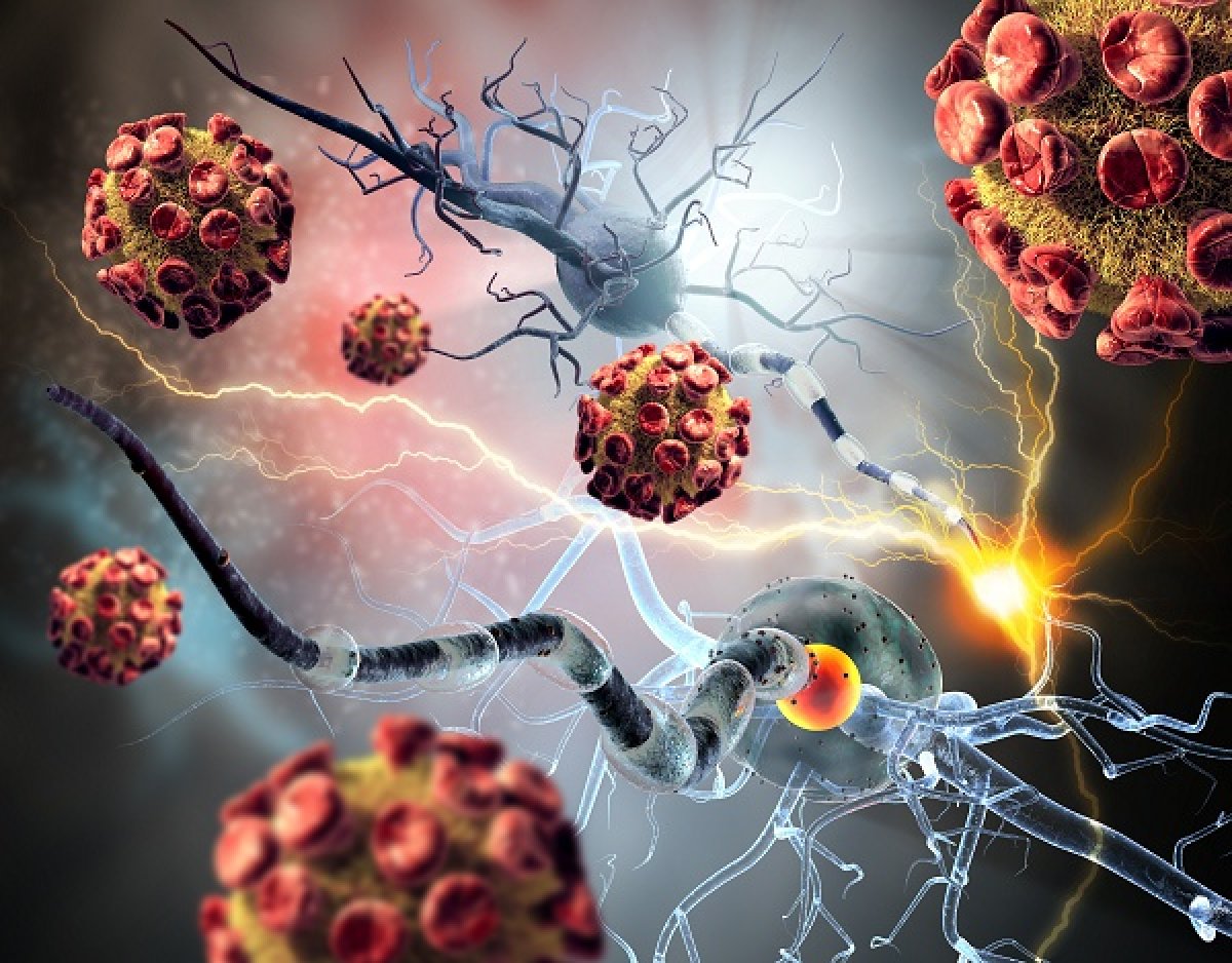 Il test MGMT di MDxHealth identifica i pazienti affetti da tumore al cervello