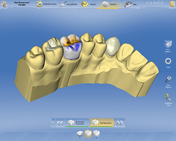 L'utilizzo del software CEREC di Sirona più semplice che mai grazie a una nuova interfaccia