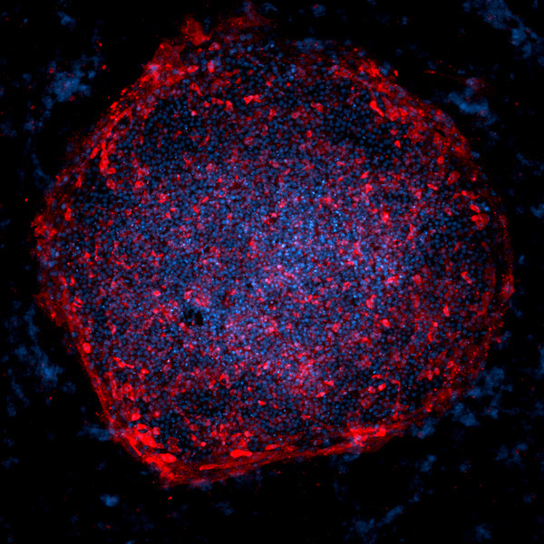 Merck Millipore amplia la gamma di kit di riprogrammazione a vettore singolo