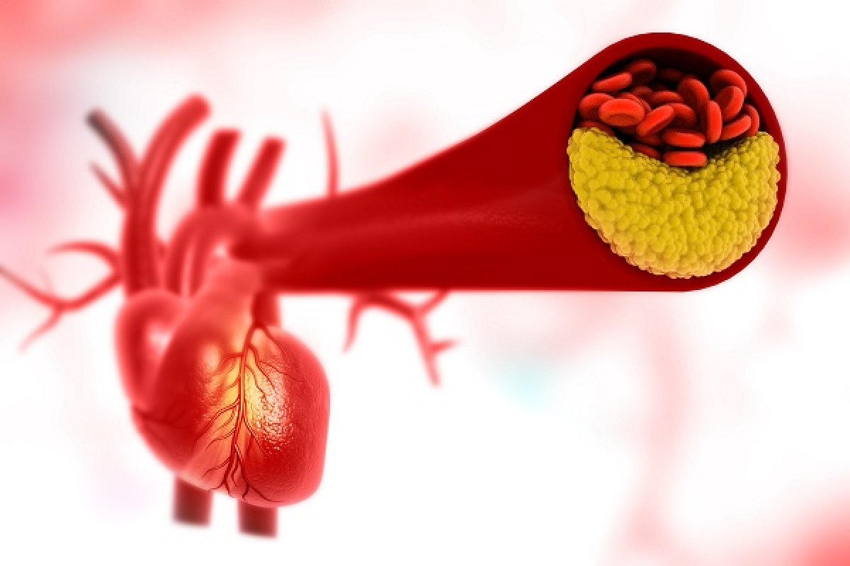 Nuova molecola cardioprotettiva TRO40303 nell'infarto acuto del miocardio
