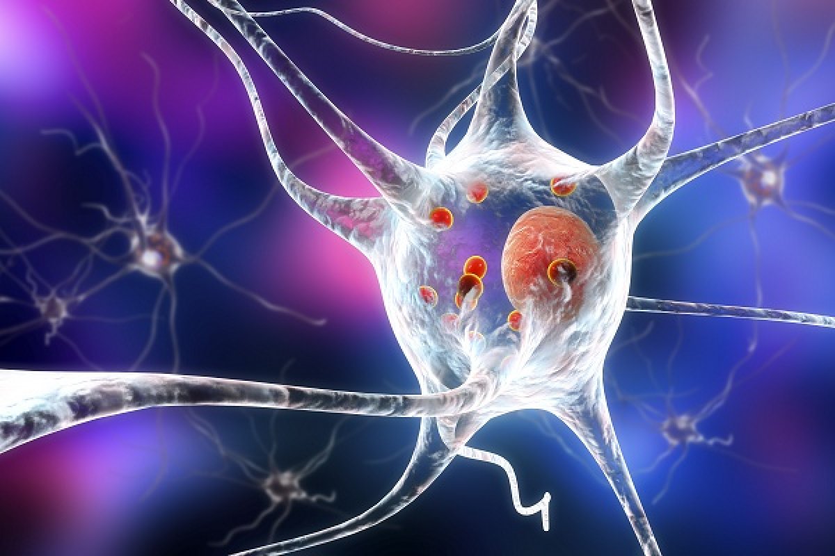 Nuovi agenti terapeutici contro il bersaglio LRRK2 della malattia di Parkinson