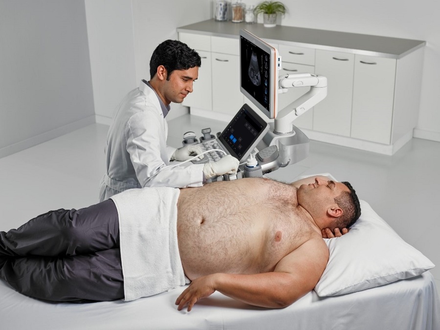 Nuovo sistema ecografico Siemens per i pazienti affetti da obesità