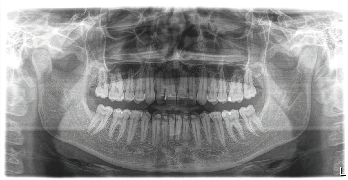 Orthophos SL offre il meglio della radiologia 2D e 3D