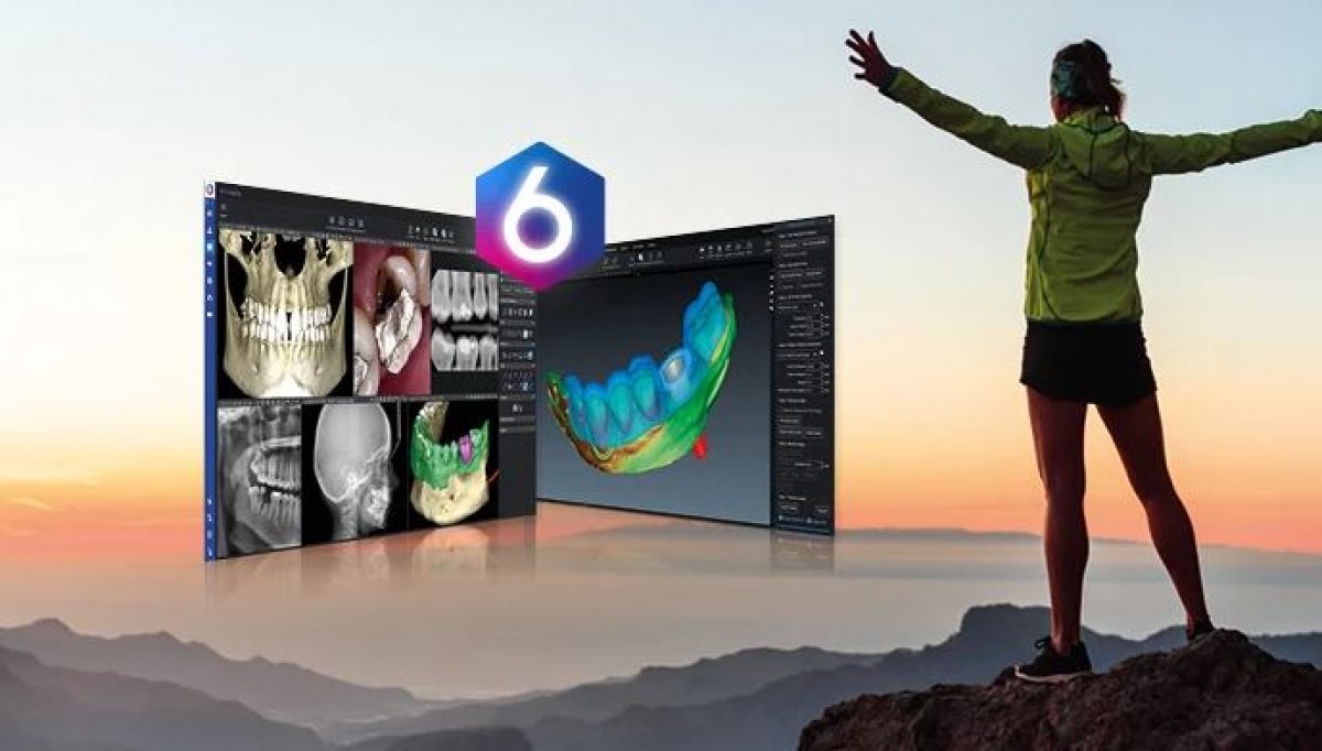 Planmeca Romexis® 6.0: la nuova versione della piattaforma software di riferimento