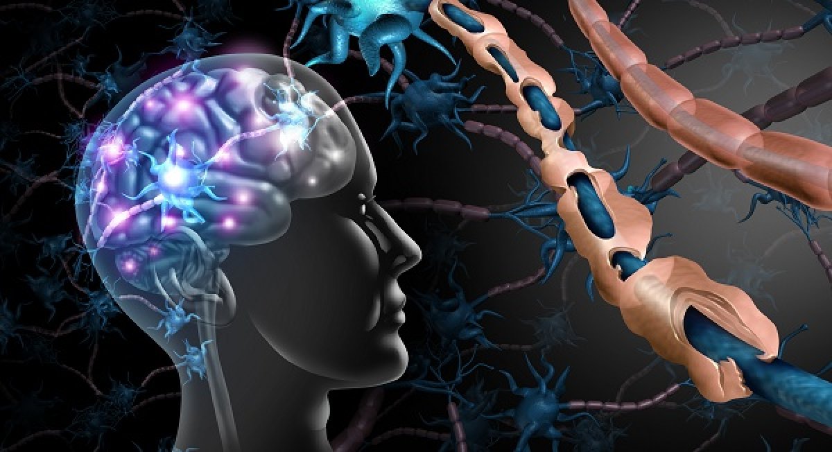 Sclerosi Laterale Amiotrofica, Trophos annuncia i risultati del suo studio