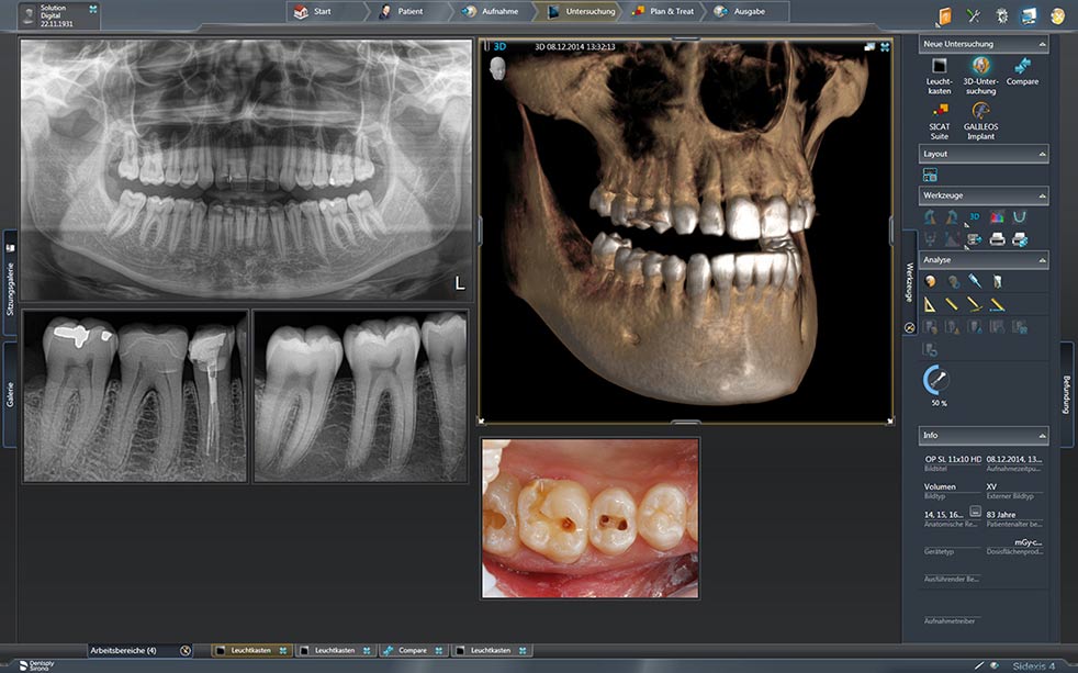 Sidexis 4, il software di gestione dei sistemi radiografici di Dentsply Sirona
