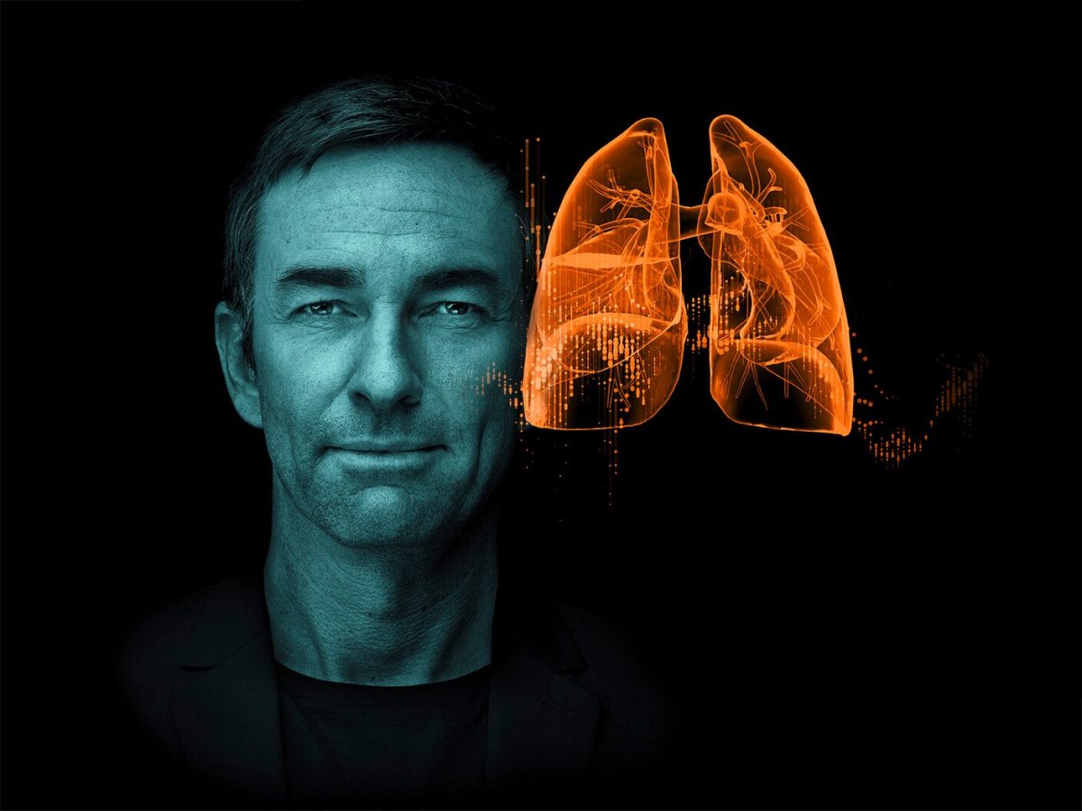 Siemens Healthineers sviluppa uno strumento basato sull'intelligenza artificiale