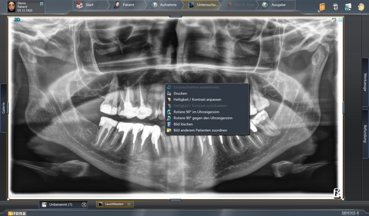 Software di radiologia SIDEXIS 4: ancora più performante