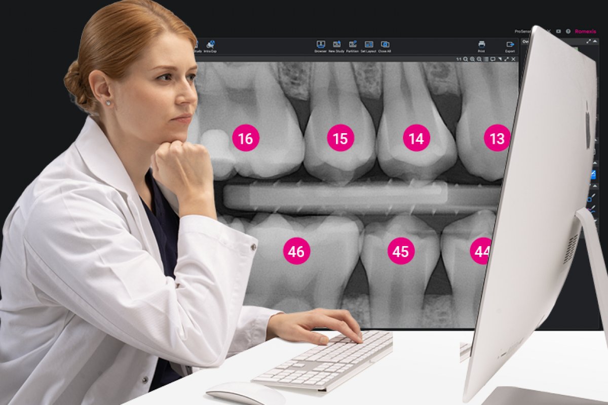 Strumenti di IA per l'imaging intraorale nel software Planmeca Romexis® 7