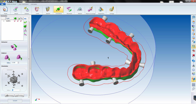 WorkNC Dental al Week End della CFAO Dentale 2014: il contributo del digitale in Implantologia